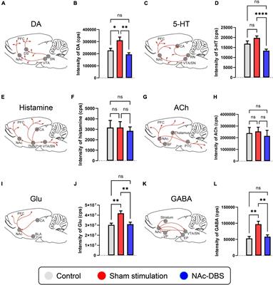 Potential therapeutic mechanism of deep brain stimulation of the nucleus accumbens in obsessive-compulsive disorder